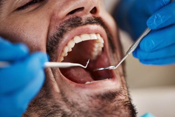 Dental X-Rays and Imaging in Richville, OH